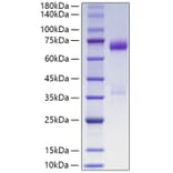 SDS-PAGE - Recombinant Human ANGPTL3 Protein (C-terminal His Tag) (A330104) - Antibodies.com