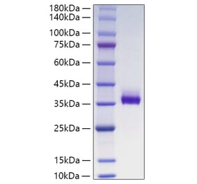 SDS-PAGE - Recombinant Human ANGPTL3 Protein (C-terminal His Tag) (A330105) - Antibodies.com