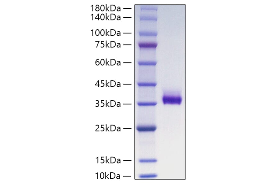SDS-PAGE - Recombinant Human ANGPTL3 Protein (C-terminal His Tag) (A330105) - Antibodies.com