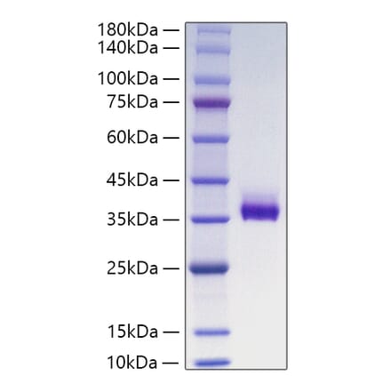 SDS-PAGE - Recombinant Human ANGPTL3 Protein (C-terminal His Tag) (A330105) - Antibodies.com