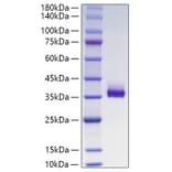 SDS-PAGE - Recombinant Human ANGPTL3 Protein (C-terminal His Tag) (A330105) - Antibodies.com
