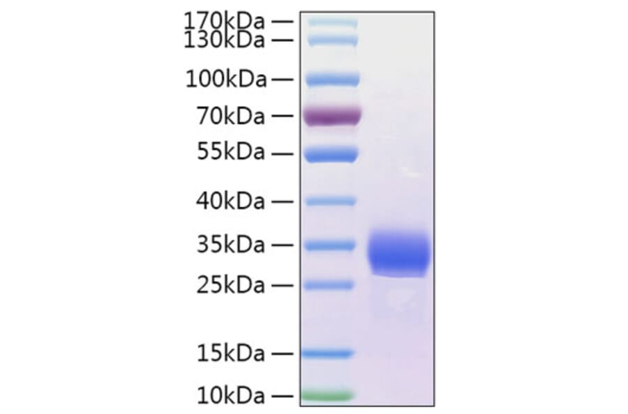 SDS-PAGE - Recombinant Human ANGPTL4 Protein (N-terminal His Tag) (A330106) - Antibodies.com