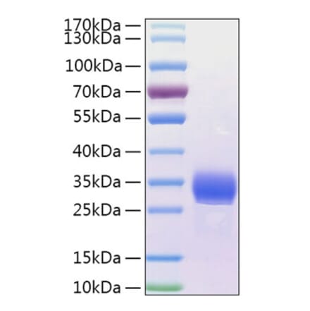 SDS-PAGE - Recombinant Human ANGPTL4 Protein (N-terminal His Tag) (A330106) - Antibodies.com