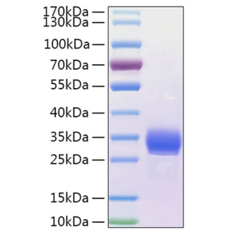 SDS-PAGE - Recombinant Human ANGPTL4 Protein (N-terminal His Tag) (A330106) - Antibodies.com