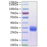 SDS-PAGE - Recombinant Human ANGPTL4 Protein (N-terminal His Tag) (A330106) - Antibodies.com