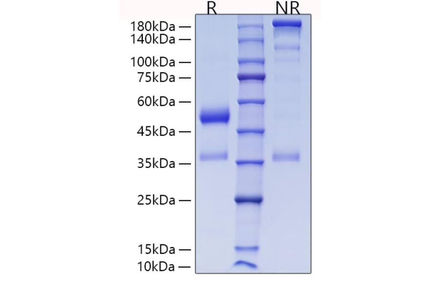 SDS-PAGE - Recombinant Human ANGPTL7 Protein (C-terminal His Tag) (A330107) - Antibodies.com