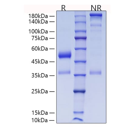 SDS-PAGE - Recombinant Human ANGPTL7 Protein (C-terminal His Tag) (A330107) - Antibodies.com