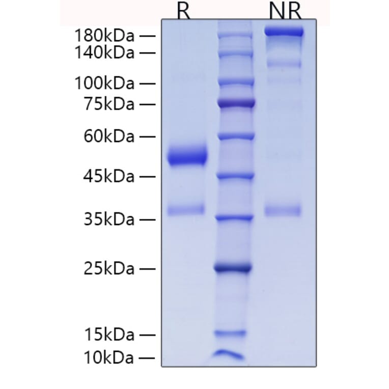 SDS-PAGE - Recombinant Human ANGPTL7 Protein (C-terminal His Tag) (A330107) - Antibodies.com