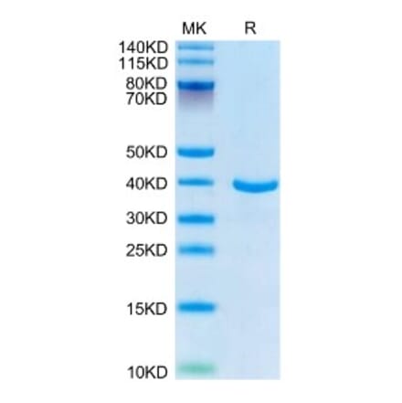 SDS-PAGE - Recombinant Human Annexin A1 Protein (C-terminal His Tag) (A330108) - Antibodies.com
