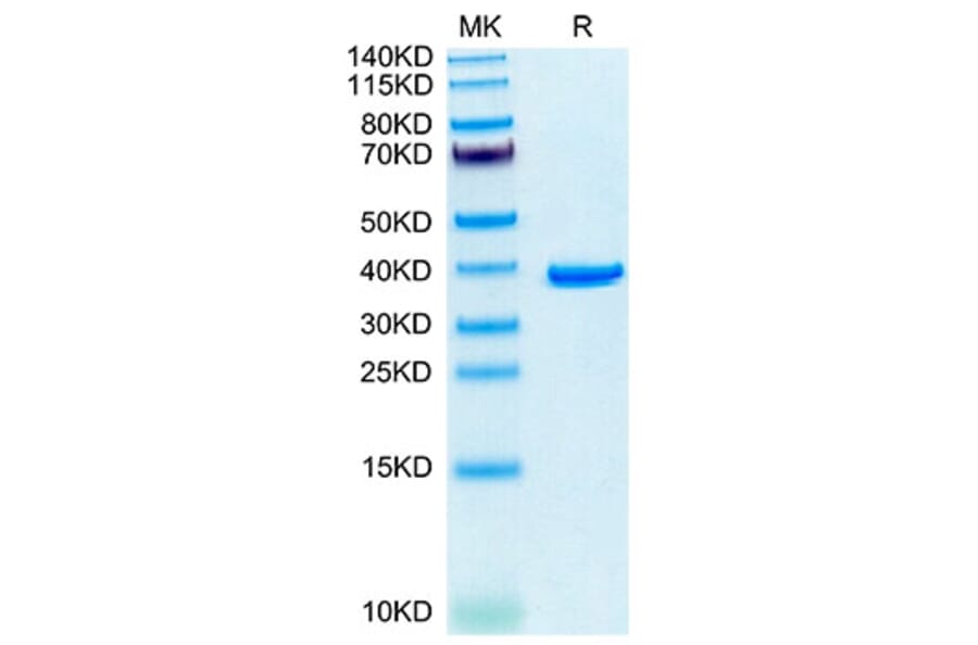 Tris-Bis PAGE - Recombinant Human Annexin A2 Protein (N-terminal His Tag) (A330109) - Antibodies.com