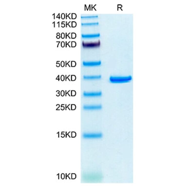 Tris-Bis PAGE - Recombinant Human Annexin A2 Protein (N-terminal His Tag) (A330109) - Antibodies.com