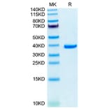 Tris-Bis PAGE - Recombinant Human Annexin A2 Protein (N-terminal His Tag) (A330109) - Antibodies.com