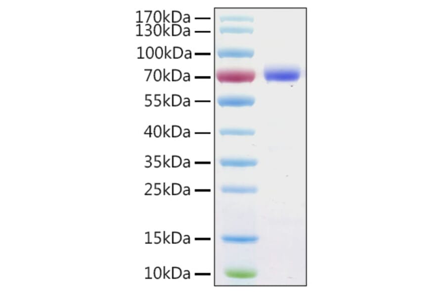SDS-PAGE - Recombinant Human Annexin A6 Protein (C-terminal His Tag) (A330110) - Antibodies.com