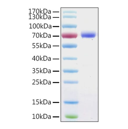 SDS-PAGE - Recombinant Human Annexin A6 Protein (C-terminal His Tag) (A330110) - Antibodies.com