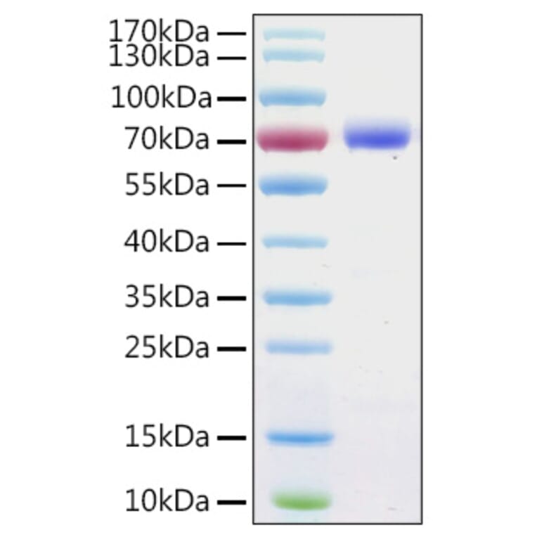 SDS-PAGE - Recombinant Human Annexin A6 Protein (C-terminal His Tag) (A330110) - Antibodies.com