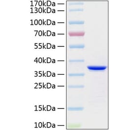 SDS-PAGE - Recombinant Human Annexin V Protein (C-terminal His Tag) (A330111) - Antibodies.com