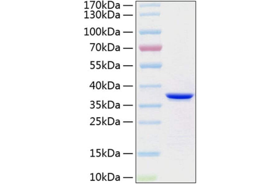 SDS-PAGE - Recombinant Human Annexin V Protein (C-terminal His Tag) (A330111) - Antibodies.com