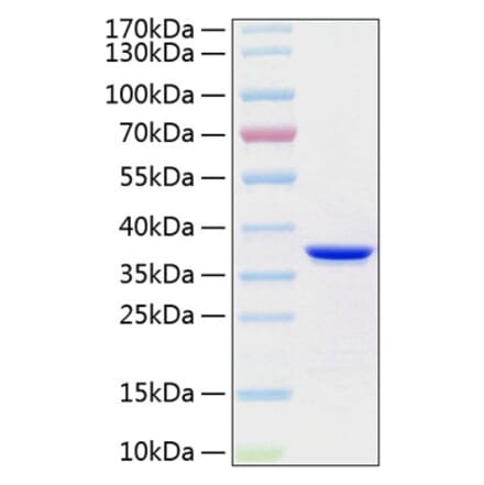 SDS-PAGE - Recombinant Human Annexin V Protein (C-terminal His Tag) (A330111) - Antibodies.com