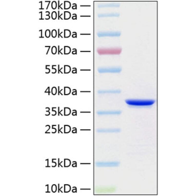 SDS-PAGE - Recombinant Human Annexin V Protein (C-terminal His Tag) (A330111) - Antibodies.com