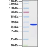SDS-PAGE - Recombinant Human Annexin V Protein (C-terminal His Tag) (A330111) - Antibodies.com