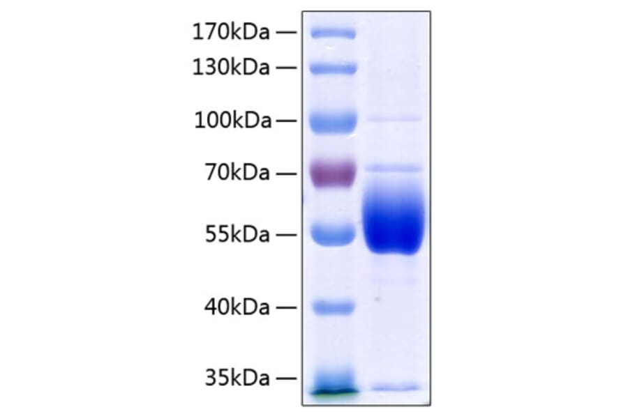 SDS-PAGE - Recombinant Human Antithrombin III Protein (C-terminal His Tag) (A330112) - Antibodies.com