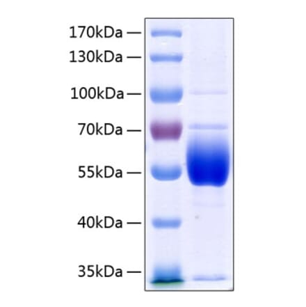 SDS-PAGE - Recombinant Human Antithrombin III Protein (C-terminal His Tag) (A330112) - Antibodies.com