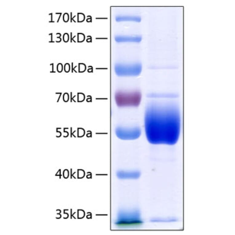SDS-PAGE - Recombinant Human Antithrombin III Protein (C-terminal His Tag) (A330112) - Antibodies.com