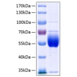 SDS-PAGE - Recombinant Human Antithrombin III Protein (C-terminal His Tag) (A330112) - Antibodies.com