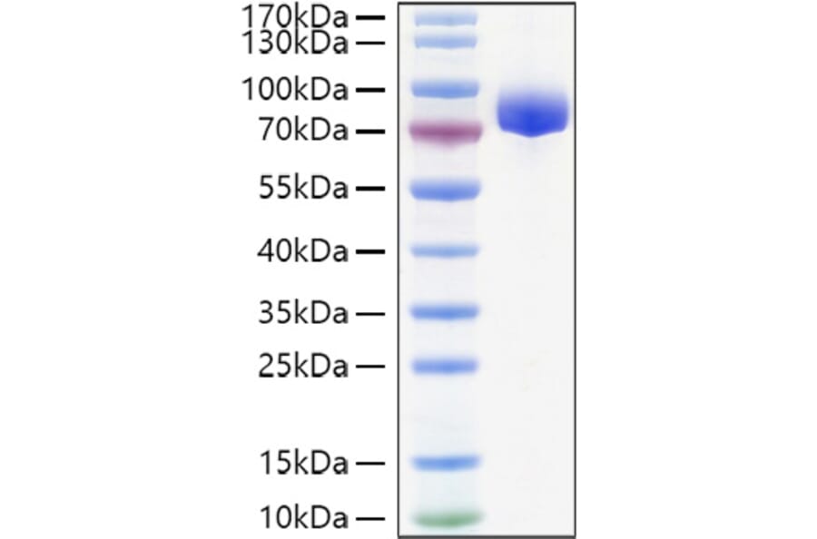 SDS-PAGE - Recombinant Human APLP1 Protein (C-terminal His Tag) (A330113) - Antibodies.com