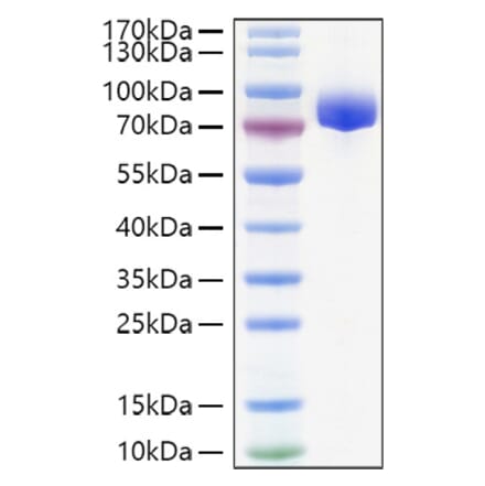 SDS-PAGE - Recombinant Human APLP1 Protein (C-terminal His Tag) (A330113) - Antibodies.com