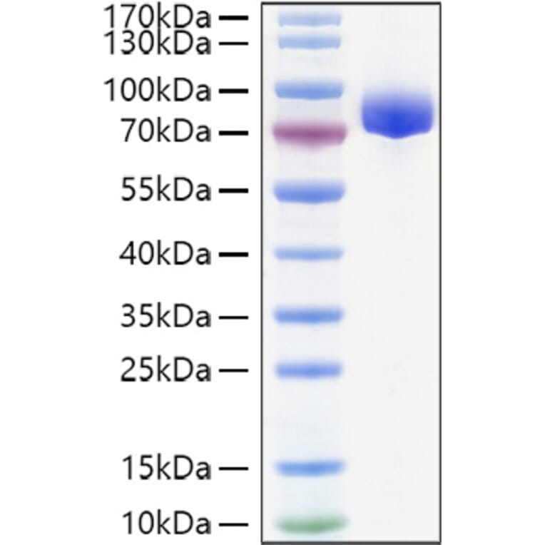 SDS-PAGE - Recombinant Human APLP1 Protein (C-terminal His Tag) (A330113) - Antibodies.com