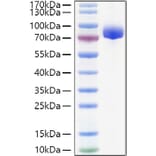 SDS-PAGE - Recombinant Human APLP1 Protein (C-terminal His Tag) (A330113) - Antibodies.com