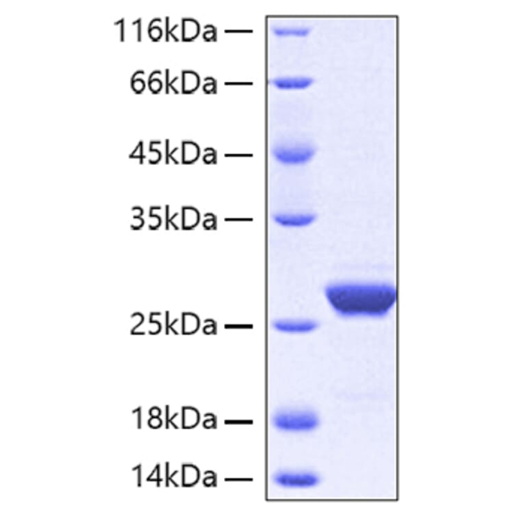SDS-PAGE - Recombinant Human ApoA1 Protein (A330114) - Antibodies.com