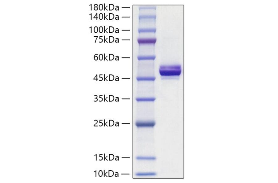 SDS-PAGE - Recombinant Human APOA4 Protein (C-terminal His Tag) (A330115) - Antibodies.com