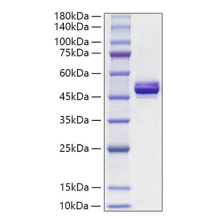 SDS-PAGE - Recombinant Human APOA4 Protein (C-terminal His Tag) (A330115) - Antibodies.com
