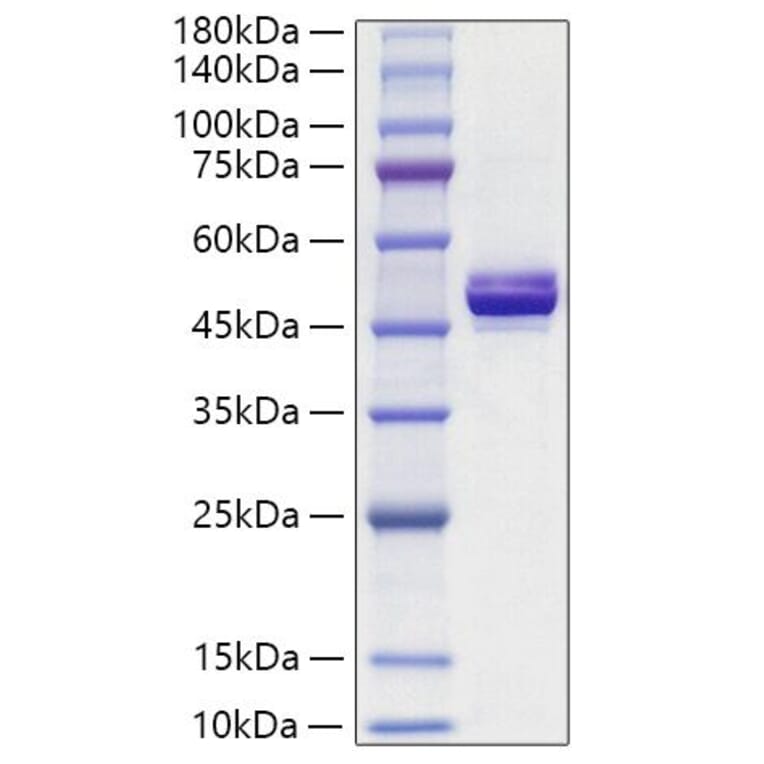 SDS-PAGE - Recombinant Human APOA4 Protein (C-terminal His Tag) (A330115) - Antibodies.com
