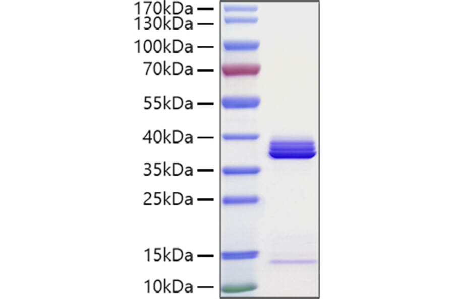 SDS-PAGE - Recombinant Human APOE Protein (C-terminal His Tag) (A330116) - Antibodies.com