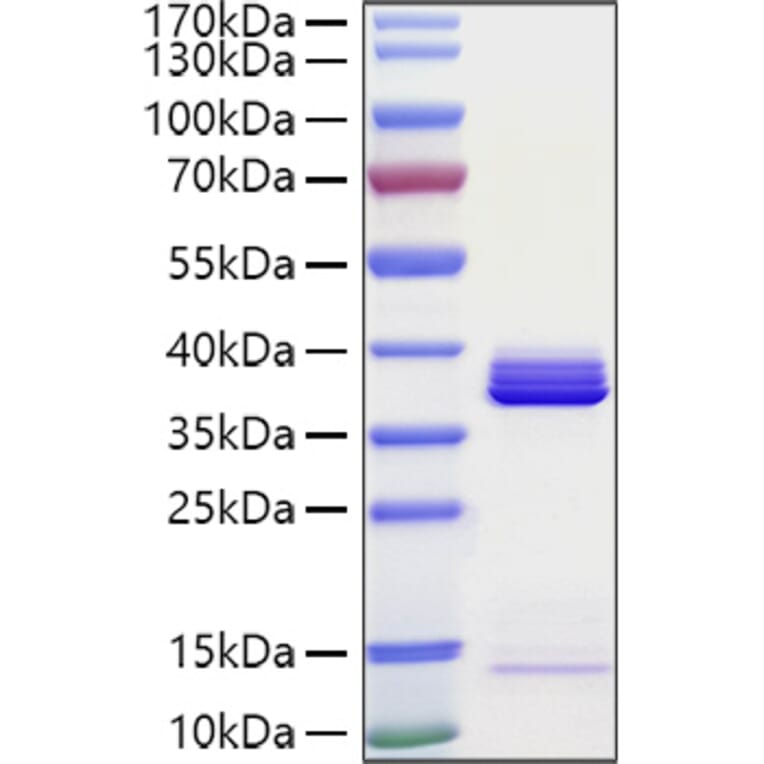SDS-PAGE - Recombinant Human APOE Protein (C-terminal His Tag) (A330116) - Antibodies.com