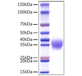 SDS-PAGE - Recombinant Human APOH Protein (C-terminal His Tag) (A330117) - Antibodies.com