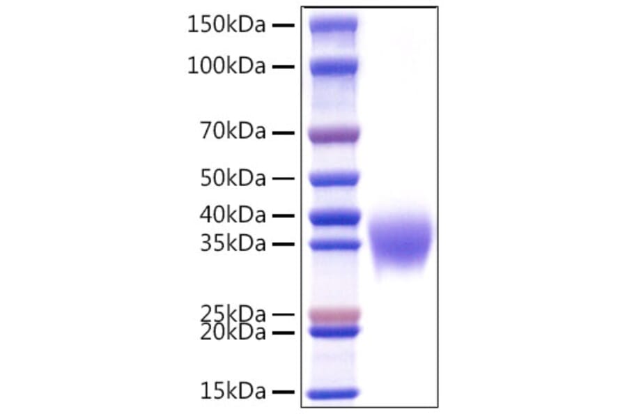 SDS-PAGE - Recombinant Human APOH Protein (C-terminal His Tag) (A330117) - Antibodies.com