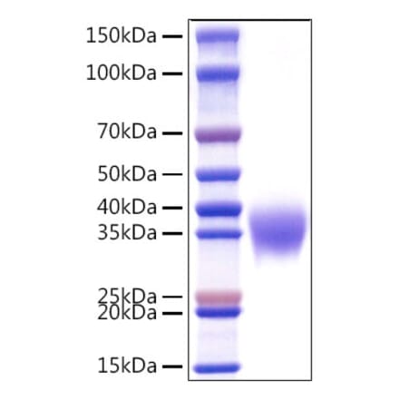 SDS-PAGE - Recombinant Human APOH Protein (C-terminal His Tag) (A330117) - Antibodies.com