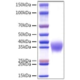 SDS-PAGE - Recombinant Human APOH Protein (C-terminal His Tag) (A330117) - Antibodies.com
