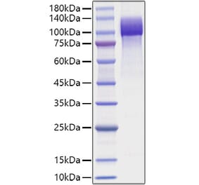 SDS-PAGE - Recombinant Human APP Protein (C-terminal His Tag) (A330119) - Antibodies.com