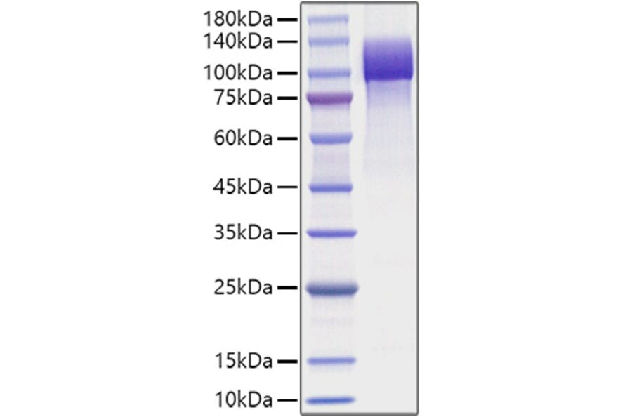 SDS-PAGE - Recombinant Human APP Protein (C-terminal His Tag) (A330119) - Antibodies.com