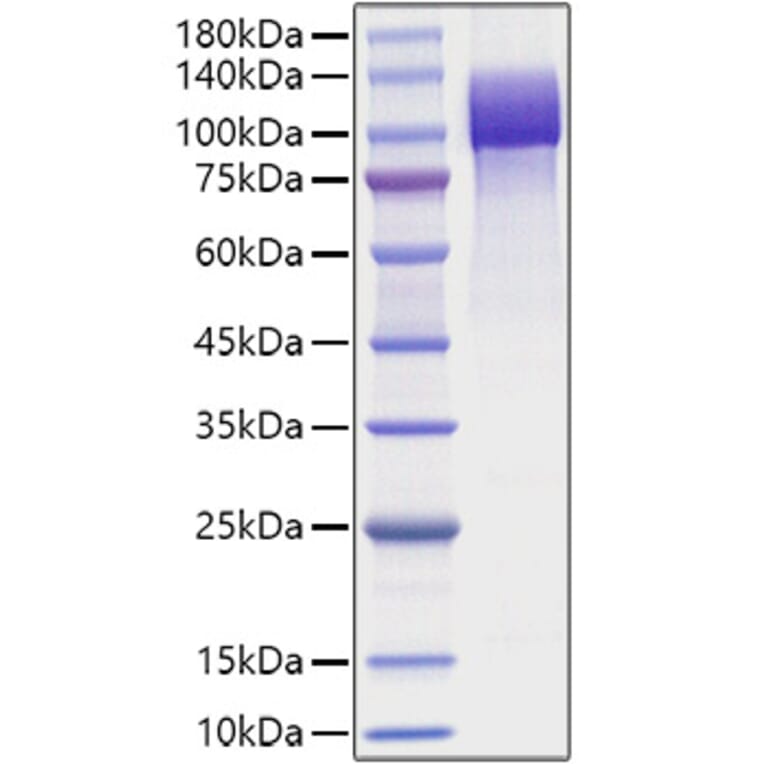 SDS-PAGE - Recombinant Human APP Protein (C-terminal His Tag) (A330119) - Antibodies.com