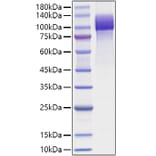 SDS-PAGE - Recombinant Human APP Protein (C-terminal His Tag) (A330119) - Antibodies.com