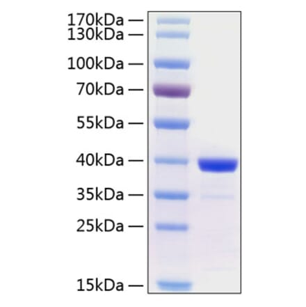 SDS-PAGE - Recombinant Human Arginase 1 Protein (C-terminal His Tag) (A330120) - Antibodies.com