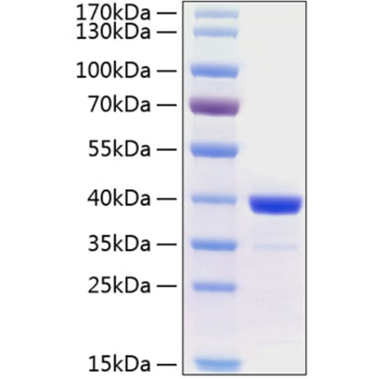 SDS-PAGE - Recombinant Human Arginase 1 Protein (C-terminal His Tag) (A330120) - Antibodies.com
