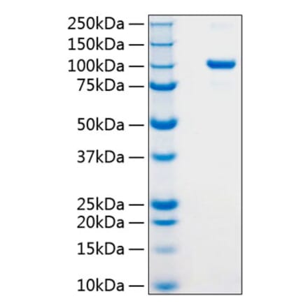 SDS-PAGE - Recombinant Human Argonaute 2 Protein (N-terminal His Tag) (A330121) - Antibodies.com