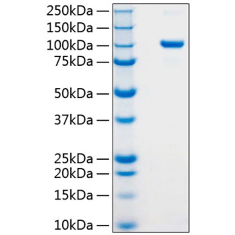 SDS-PAGE - Recombinant Human Argonaute 2 Protein (N-terminal His Tag) (A330121) - Antibodies.com
